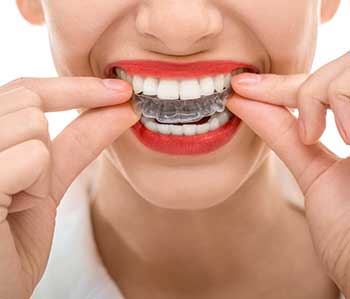 Invisalign in West Hempstead