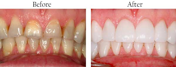 dental images 11552